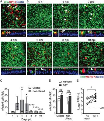 Inter-individual Variation in Receptor Expression Influences MERS-CoV Infection and Immune Responses in Airway Epithelia